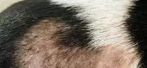 脂溢性脱发有什么好方法?