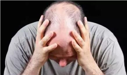 影响头发生长的因素有哪些？
