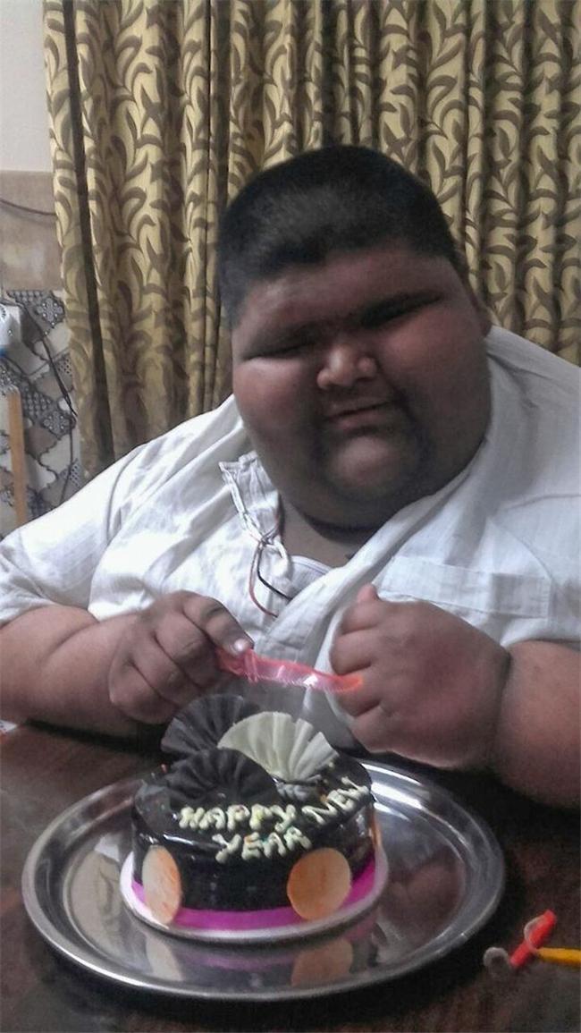 14岁474斤，被称为“世界上最胖的孩子”，胖到眼睛都睁不开