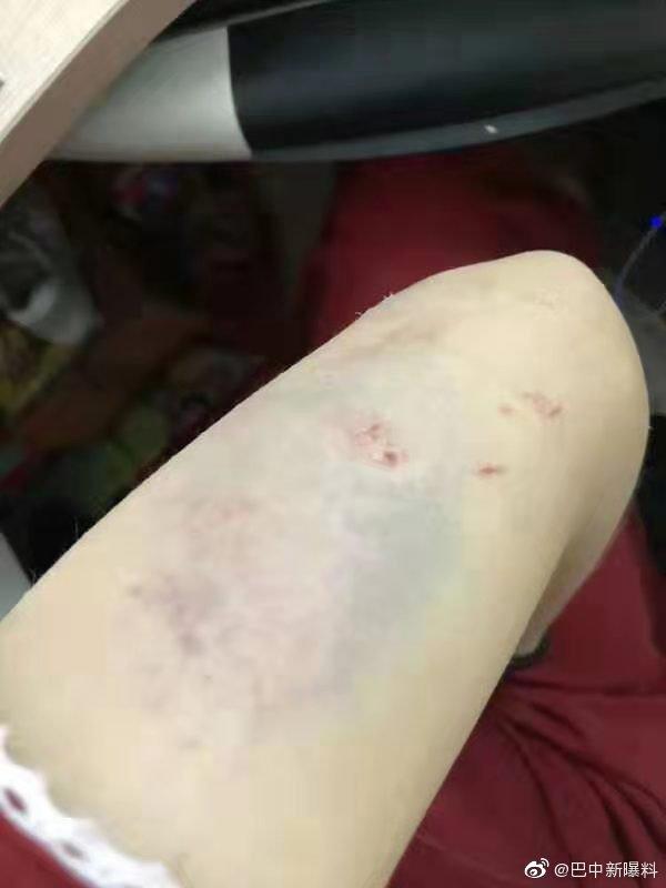 巴中26岁美女教师不忍家暴跳楼身亡！牙齿曾被打掉两次……