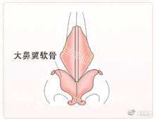 工匠的技术-3【鼻中隔延长术】