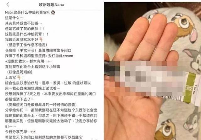 欧阳娜娜透露治痘秘方，结果却是擦拭下面的药！这气氛好尴尬