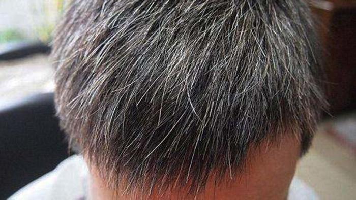 白发变黑的方法有效果吗？真的能让白发彻底变成黑发吗？