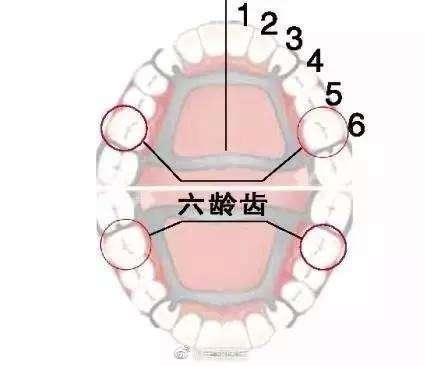 为什么说预防“六龄牙”龋齿很重要