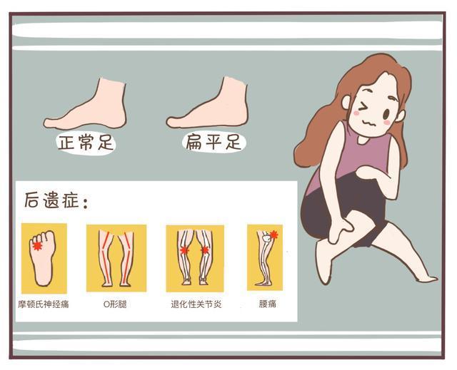 一幅漫画了解扁平足的危害及防治方法