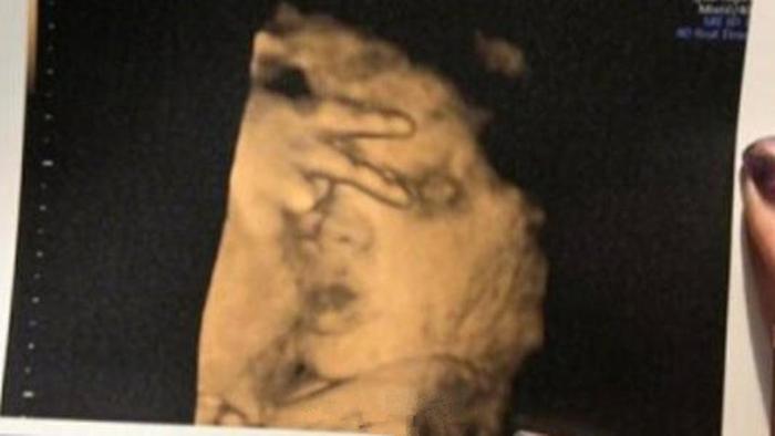 孕检时，胎儿表情究竟多可爱！比剪刀手、竖大拇指、打哈欠……