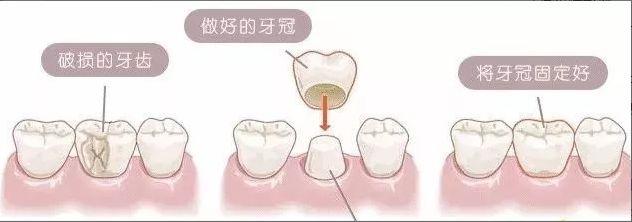 宋祖儿随身带“牙齿橡皮擦”，要不要这么拼？