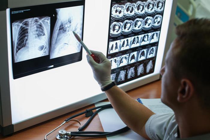 九个月里再获 FDA 批准，Aidoc 的 AI 肺栓塞筛查方案已纳入医院工作流程
