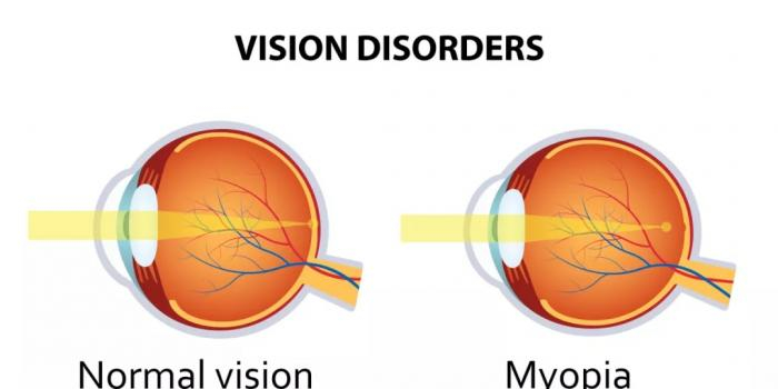 爱眼日系列│那些做了近视矫正手术的人,老了