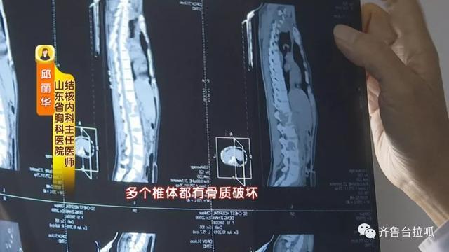 21岁赴新疆支教女孩罹患重病，她说：“后悔没能跟学生好好告别”