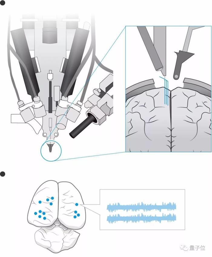 马斯克发布脑机接口系统！芯片直连大脑，激光开颅放置，可用iPhone操控，网友炸了：这就是黑客帝国