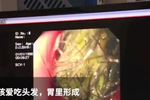 9岁女孩胃里有石头?检查才发现,平时误食,妈妈无奈