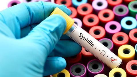 法媒：梅毒在欧洲死灰复燃 病例首次超过艾滋病