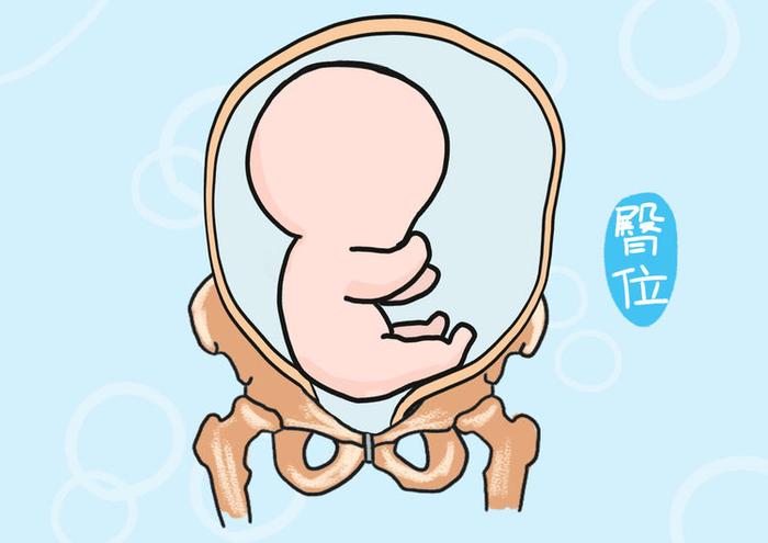 多半孕妈面临胎位不正，孕28周是临界点，孕妈要学会胎位“自纠”