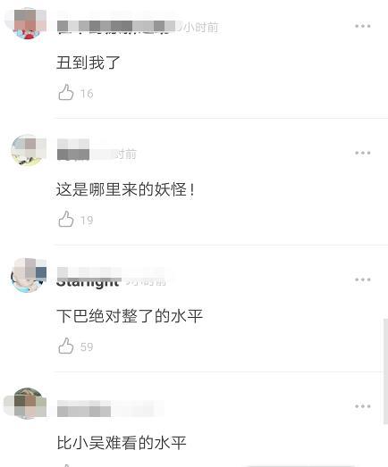 继缩鼻翼之后，王一博生图再现“整容痕迹”？网友：假体太明显了