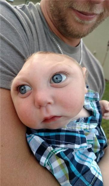 阻止进化?畸形儿是逐渐进化的人类?而现代医学却阻止...