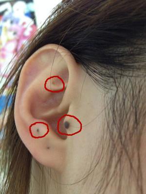 详细分析：耳朵有痣的命运好不好？左右耳有痣区别很大！