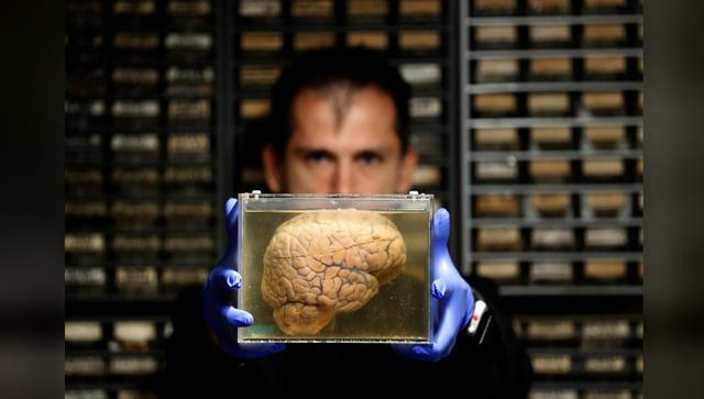 人脑只开发了10%？5个关于大脑的传言，你被骗了多久？