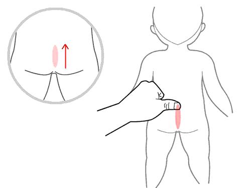 小儿秋季腹泻的中医推拿五方