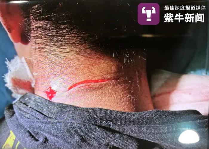【紫牛新闻】制止恶男对女子施暴被砍六刀，南京小伙担心疤痕影响参军