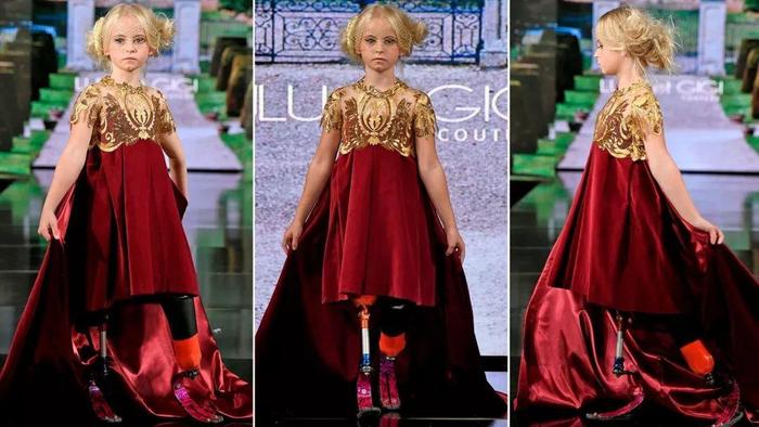失去双腿却惊艳纽约时装周，来自9岁假肢少女的逆袭