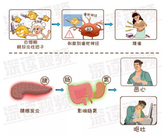 急性胰腺炎死亡率真的很高吗？