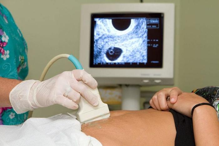 妇产科医生：二胎时，为何要比头胎多做这4项孕前检查