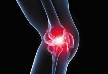 出现膝关节炎问题，一定要注意保护膝盖