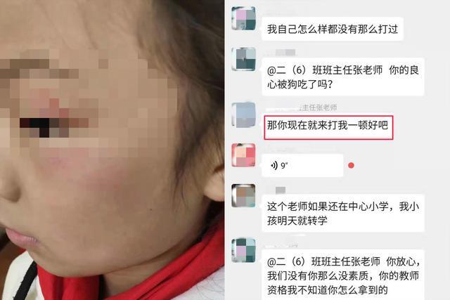 小学生写错字眼被打肿，老师反呛家长，网友：发个定位，满足你