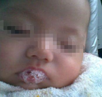2周女婴经常吐泡泡，宝妈觉得很可爱，奶奶掰开嘴巴一看迷茫了
