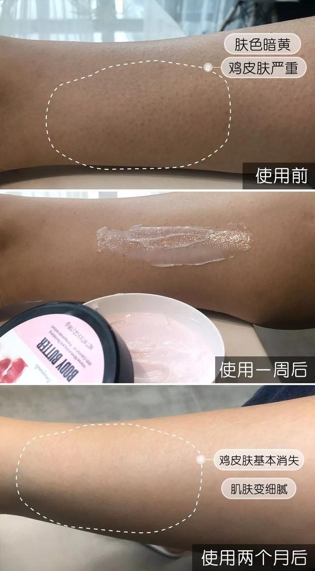 坚持涂身体乳和不涂身体乳，10年后的差别也太大了吧