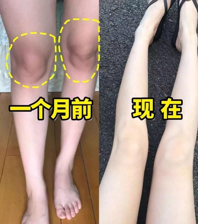 坚持涂身体乳和不涂身体乳，10年后的差别也太大了吧