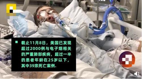 合群那么重要吗？美国14岁男孩为了合群吸食大量电子烟导致癫痫