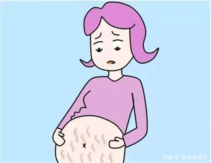 孕期妊娠纹也挑人？有这4类特征的孕妈多半不会长，看你符合几项