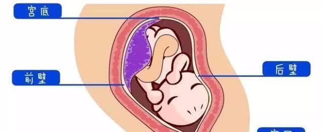 怀孕时，胎儿位置在前壁或者后壁有什么区别？风险程度大不同
