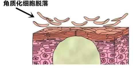 清潭：听说最“致命”的肌肤问题就是毛孔粗大？