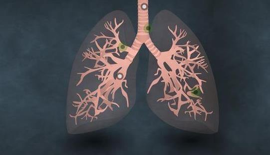 肺部受损时，身体会出现这3个表现，还请检查一次肺部！
