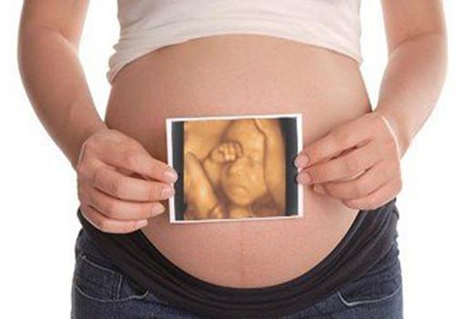 胎儿“太害羞”，做四维总是不露脸，孕妇很着急，医生却说没关系