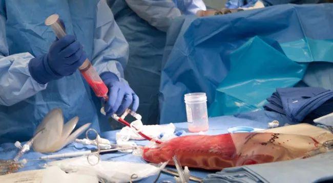 骨髓移植后，男人的身体正被捐献者的DNA“吞噬”
