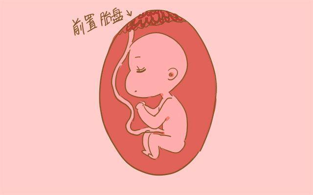 剖腹产后的3个后遗症，生二胎时会更明显，准妈妈要心里有数