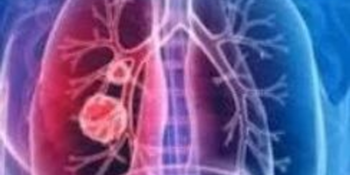 最近是不是有新型病毒 w700h350z1l10t10996.jpg