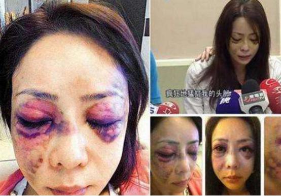 被家暴过的女明星，黄奕将照片公布于众，她被殴打至脑震荡