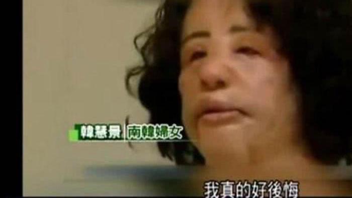 她天生丽质却痴恋整容，后因意外导致毁容，去世时年仅57岁