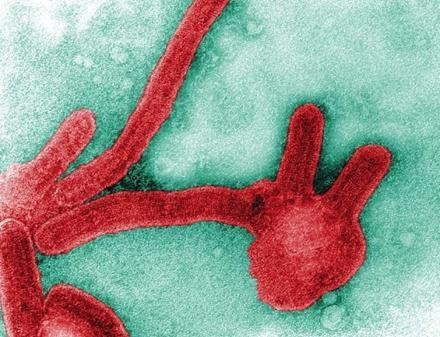 马尔堡病毒，和埃博拉齐名，病死率很高