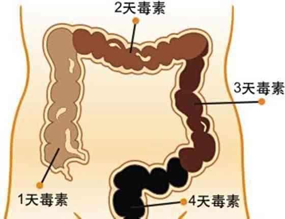 经常放屁是身体在排毒？有可能是身体出了问题，千万别忽视