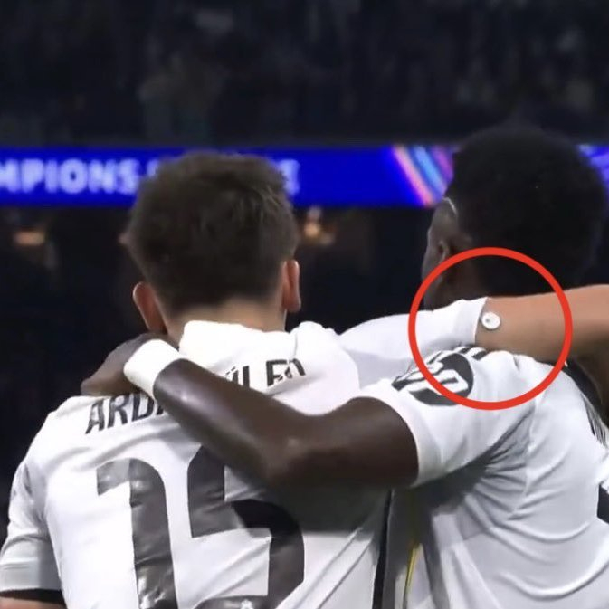 皇马球员居勒比赛中佩戴血糖监测仪引关注