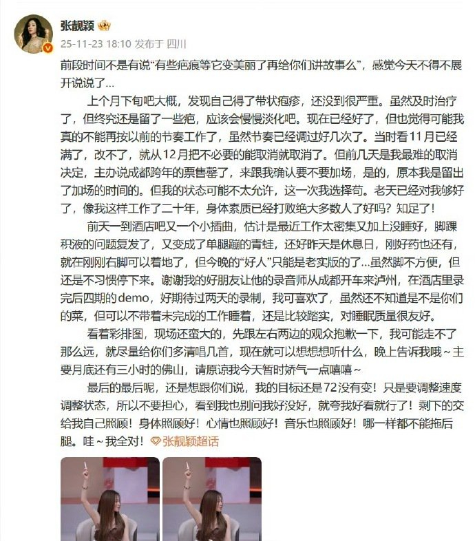 张靓颖因带状疱疹取消成都跨年加场