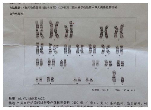 高龄备孕二胎并没有那么难，也许做好这些就中奖了