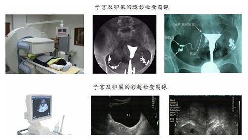 高龄备孕二胎并没有那么难，也许做好这些就中奖了