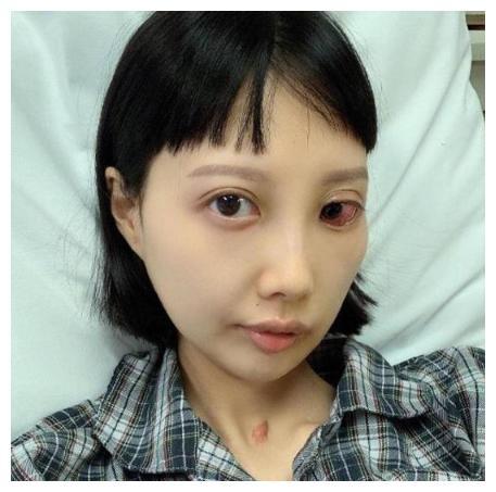 女星李明蔚抗癌七年，一边流鼻涕口水一边化妆，靠血液续命